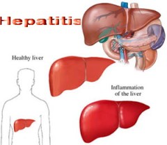 obat hepatitis